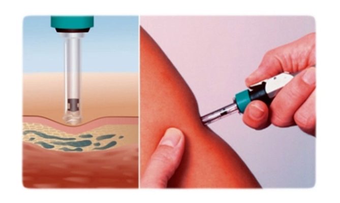 注射器密合性正壓負(fù)壓測(cè)試儀對(duì)器身密封性質(zhì)量檢測(cè)的重要性